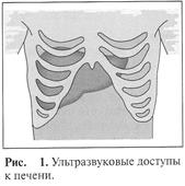 Ультразвуковая анатомия печени 1